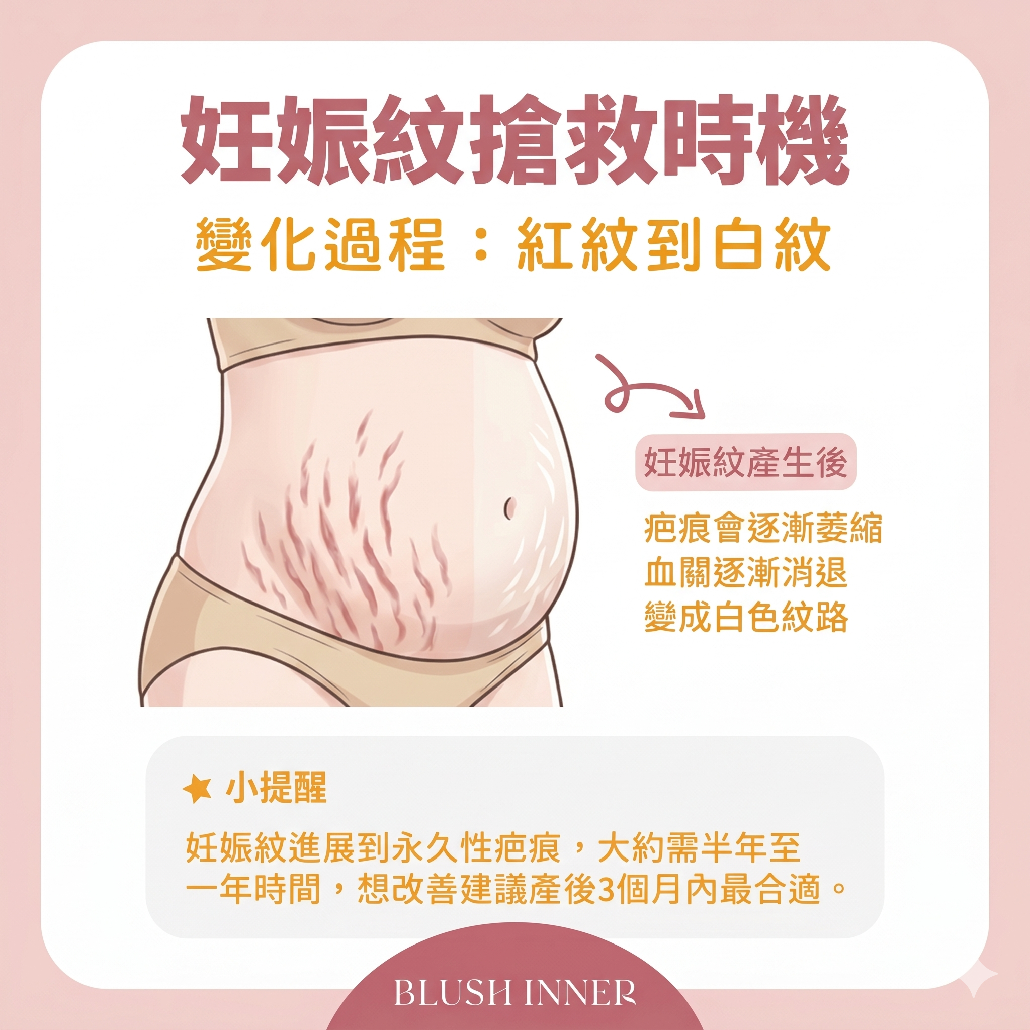 日本Nuvea Exosome Trio外泌體抗紋保濕三重奏
