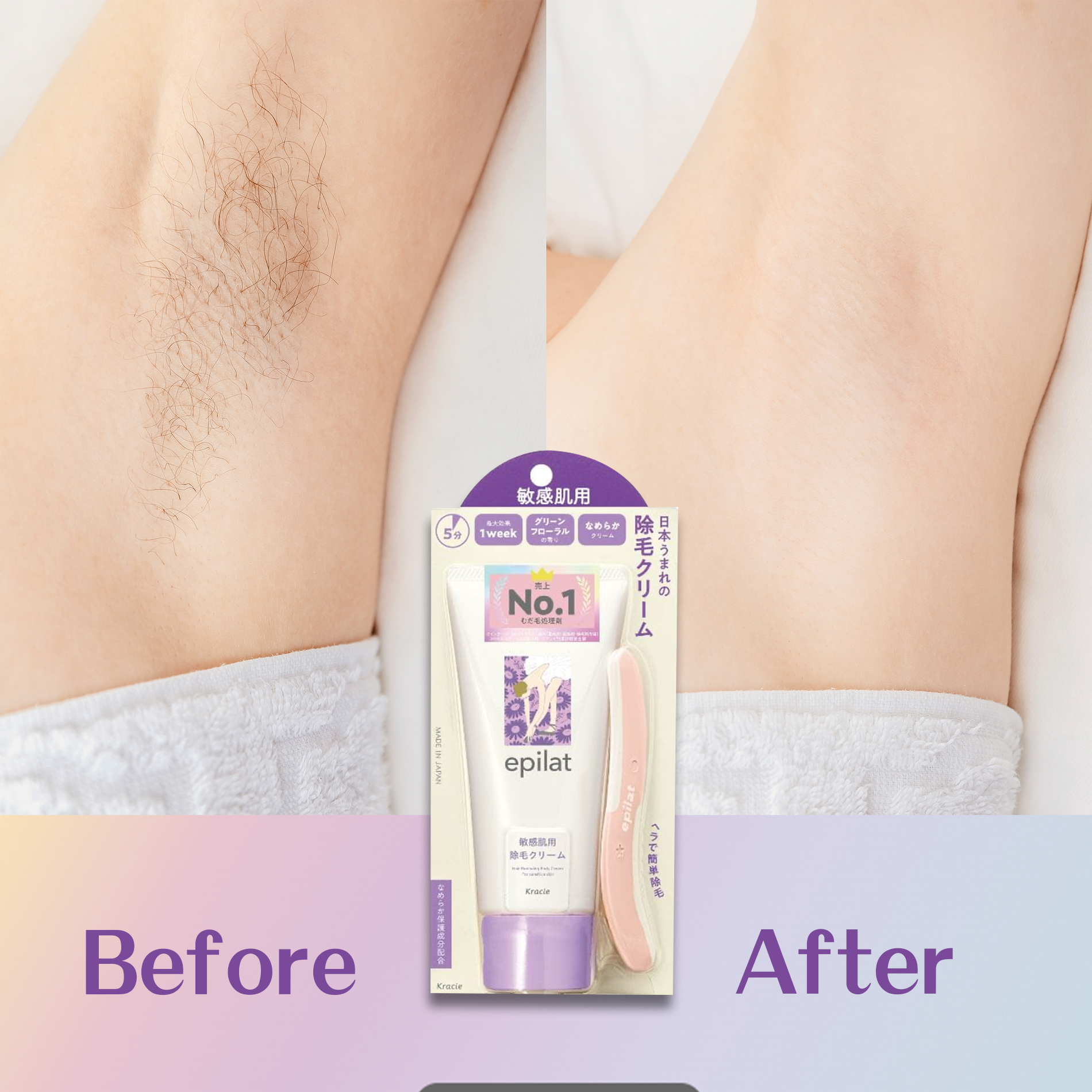 日本直送🇯🇵Epilat防敏感護膚脫毛膏