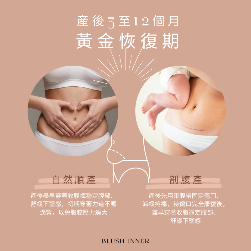 產後黃金恢復期指南圖：自然順產與剖腹產差異與建議；先束腹帶後穿收腹褲修復腹部、舒緩下垂感